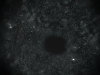 Diamond eye